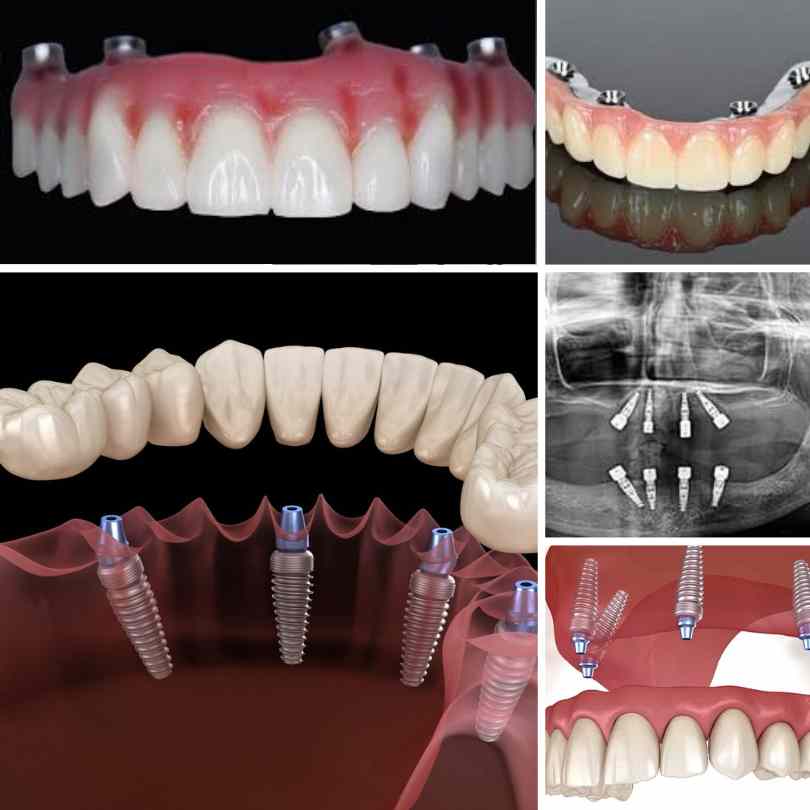 Design fără titlu Design fără titlu
