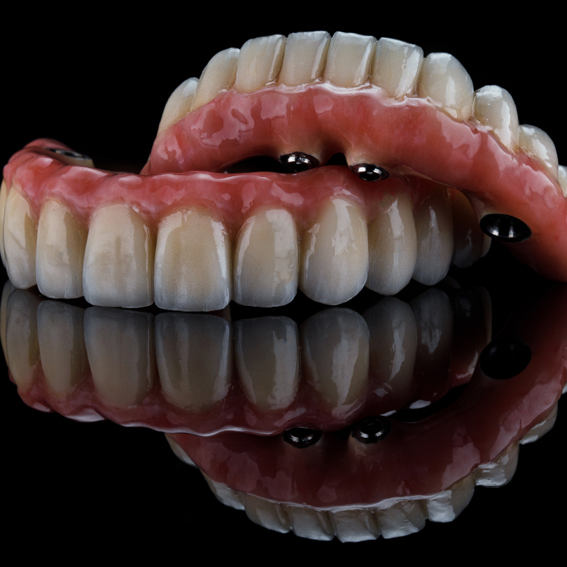 Implanturi dentare Brașov Proteze pe implanturi dentare Brașov Cost implant dentar Brașov Clinică implanturi dentare Brașov Specialist implanturi dentare Brașov Implant dentar all-on-4 Brașov Proteze dentare pe implanturi Brașov Preț proteze pe implanturi dentare Implant dentar fără durere Brașov Îngrijire după implant dentar Brașov Cea mai bună clinică de implanturi dentare Brașov Reabilitare orală cu implanturi dentare Brașov Implantologie avansată Brașov Avantaje proteze pe implanturi dentare Implanturi dentare rapide Brașov Cât costă un implant dentar în Brașov Implanturi dentare de calitate Brașov Tratamente moderne implant dentar Brașov Recuperare după proteze pe implanturi Brașov Estetica dentară cu implanturi în Brașov Implanturi dentare Brașov Proteze pe implanturi dentare Brașov Cost implant dentar Brașov Clinică implanturi dentare Brașov Specialist implanturi dentare Brașov Implant dentar all-on-4 Brașov Proteze dentare pe implanturi Brașov Preț proteze pe implanturi dentare Implant dentar fără durere Brașov Îngrijire după implant dentar Brașov Cea mai bună clinică de implanturi dentare Brașov Reabilitare orală cu implanturi dentare Brașov Implantologie avansată Brașov Avantaje proteze pe implanturi dentare Implanturi dentare rapide Brașov Cât costă un implant dentar în Brașov Implanturi dentare de calitate Brașov Tratamente moderne implant dentar Brașov Recuperare după proteze pe implanturi Brașov Estetica dentară cu implanturi în Brașov